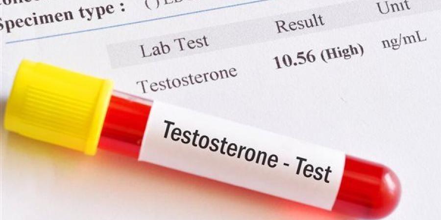 خبراء يحذرون من الترويج العشوائي لمكملات "هرمون الذكورة"